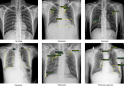 VinDr-CXR:  The largest public chest X-ray  dataset with radiologist-generated annotations for machine learning-based computer-aided diagnosis (CAD)  