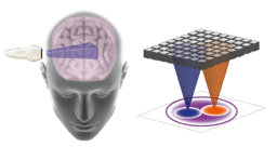 Seeing through the skull with 3D ultrasound matrix imaging