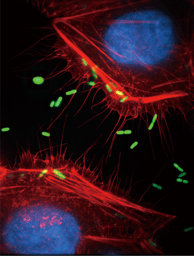 Unveiling the Intricate Mechanism of HD5-Mediated Shigella Invasion: A Scientific Odyssey