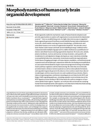 Morphodynamics of human early brain organoid development