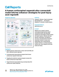 A human corticospinal organoid-slice connectoid model informs enhancer strategies for post-injury axon regrowth