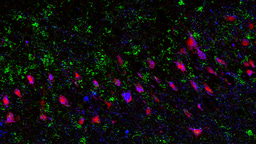 Do astrocytes of the human brain breathe?