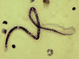 Lymphatic filariasis setbacks after COVID-19