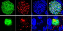 A genetically attenuated malaria vaccine candidate with superior anti-malarial immunity 