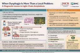 When Dysphagia Is More Than a Local Problem: A Diagnostic Lesson in Light-Chain Amyloidosis