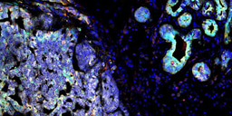 The PyMT Saga Continues