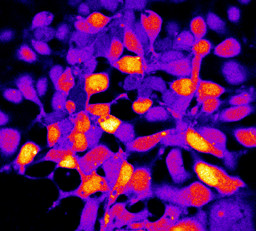 Cannabinoids Modulate Angiotensin II-Induced Calcium Signaling in Striatal Neurons: Implications for Parkinson's Disease