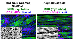 Treatment of volumetric muscle loss in mice using nanofibrillar scaffolds enhances vascular organization and integration