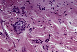 Call for papers: Fibrosis: Tissue Repair and Remodelling