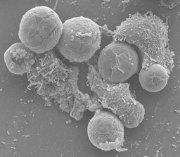 “Like zombies”: tupanvirus-infected amoebas are induced to aggregate with uninfected cells 