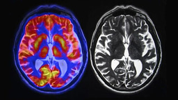 Evaluating Current Methods for Enhancing Clinical Computer Tomography (CT) Imaging Using Contrast Agents