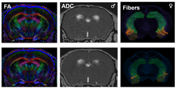 Understanding How Sex-Specific Brain Networks Influence Social Deficits in Autism