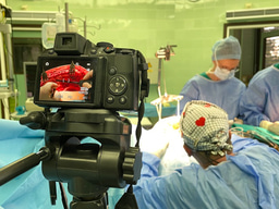 Bilateral skeletonized IMAs used as “in situ” grafts for different coronary territories: long-term propensity matching study