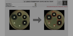 Automating Inhibition Zone Detection with YOLOv8n and LabVIEW Integration