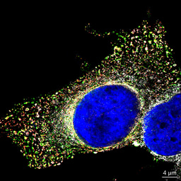 How a Cellular “Gatekeeper” Helps Viruses Thrive: Exploring NUP153 in Flavivirus Infections