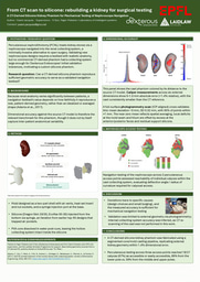 From CT scan to silicone: rebuilding a kidney for surgical testing
