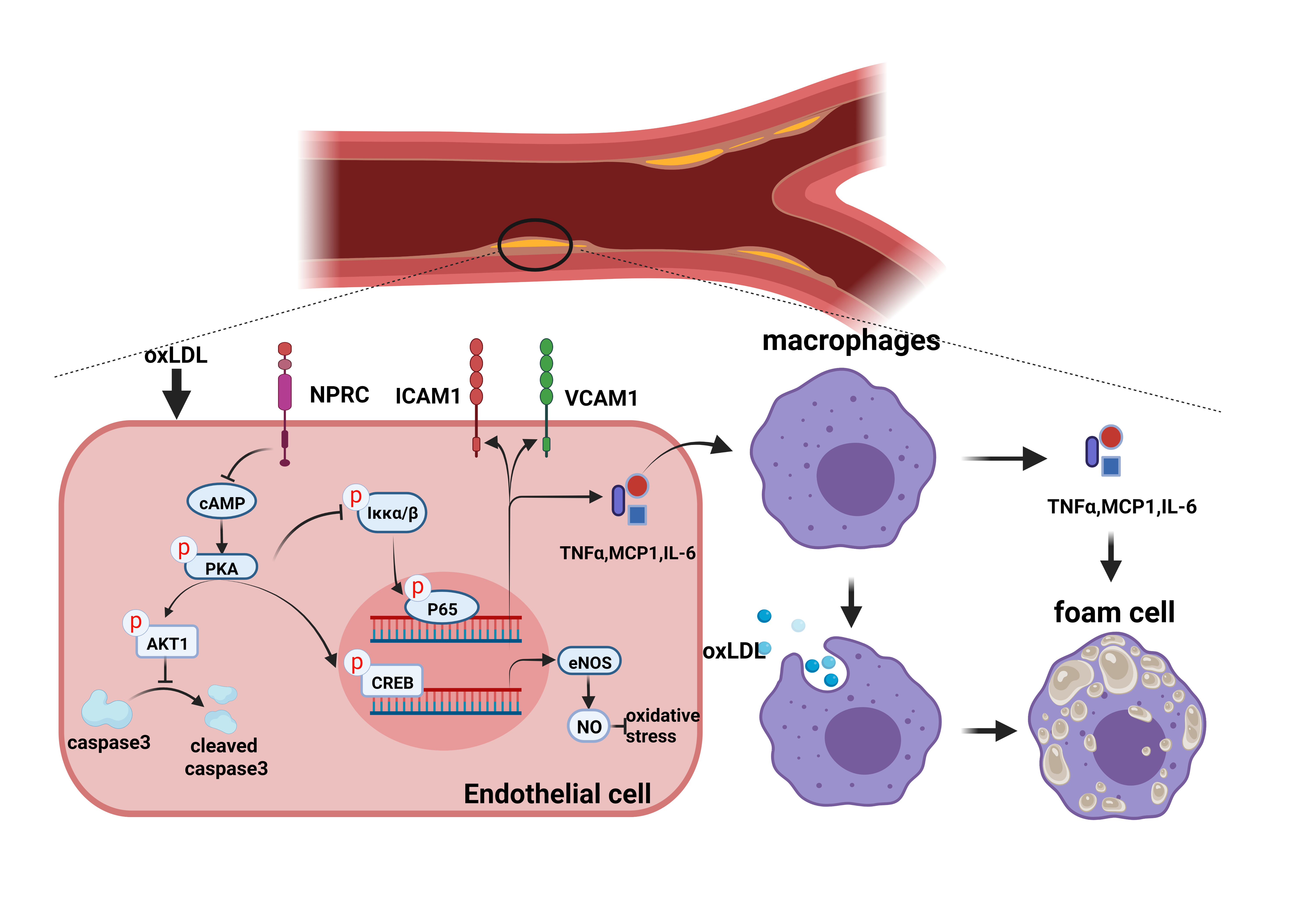 Schematic diagram showing the mechanism of NPRC- promoted atherosclerosis.