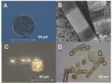 Microscope images of the larger T. baltica (A, C and D) and smaller chain forming S. marinoi (B and C). Panel A shows a freshly isolated T. baltica and D a much smaller, six month old culture, exhibiting cellular deformities and reduced growth. (C and D, authors photos, A and B courtesy of Lars Edler).