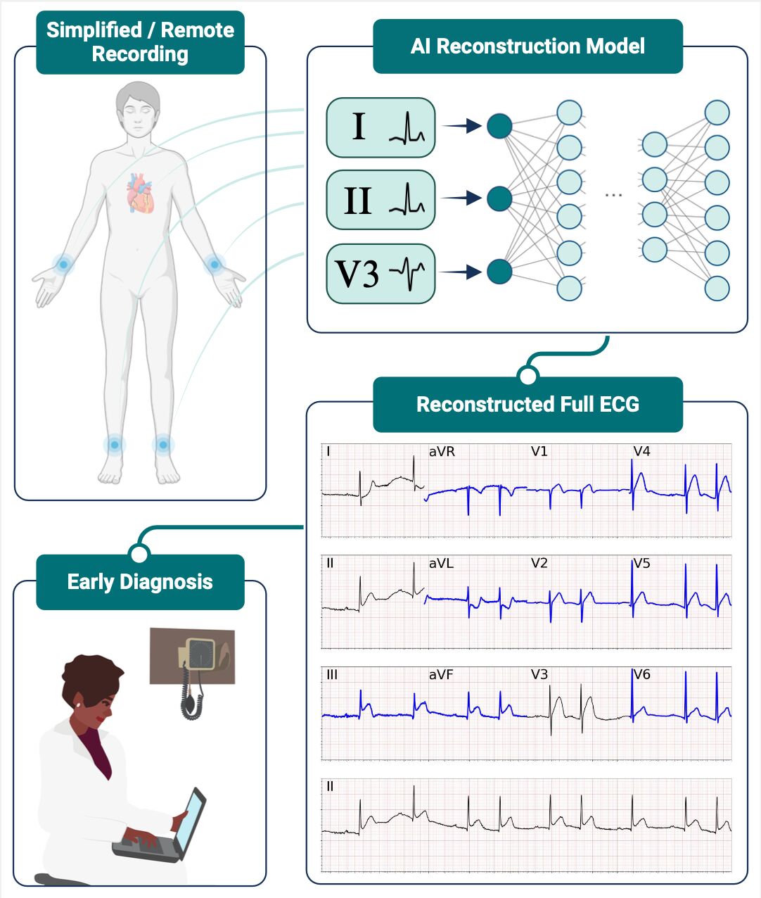 ECG Reconstruction Framework