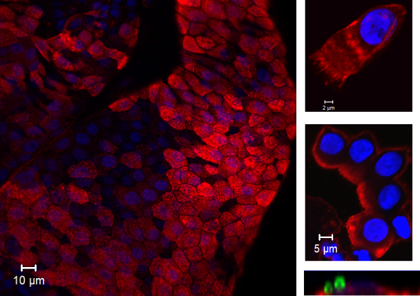 Cells collected from the EHPC biopsies. 
