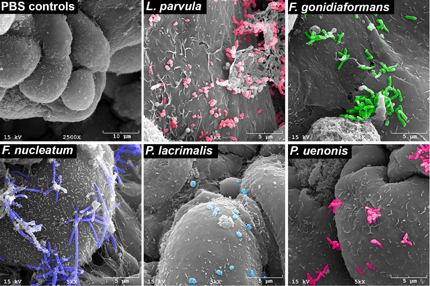 Figure 1. Scanning electron microscopy demonstrating bacterial vaginosis-associated bacteria adhering to three-dimensional human cervical cells (from Maarsingh, Laniewski, & Herbst-Kralovetz, Communications Biology, 22;5(1):725, 2022)