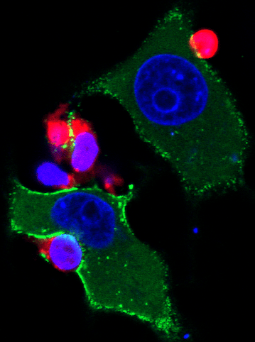 Cell-to-cell transmission of HIV