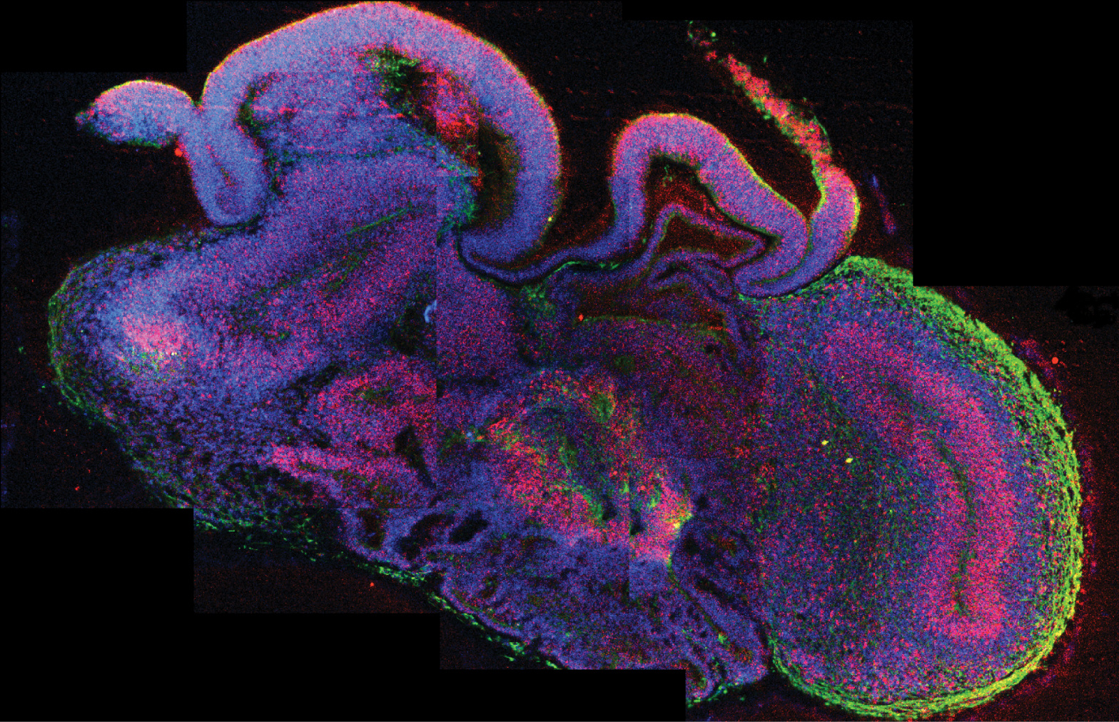 Staining of a brain organoid section.