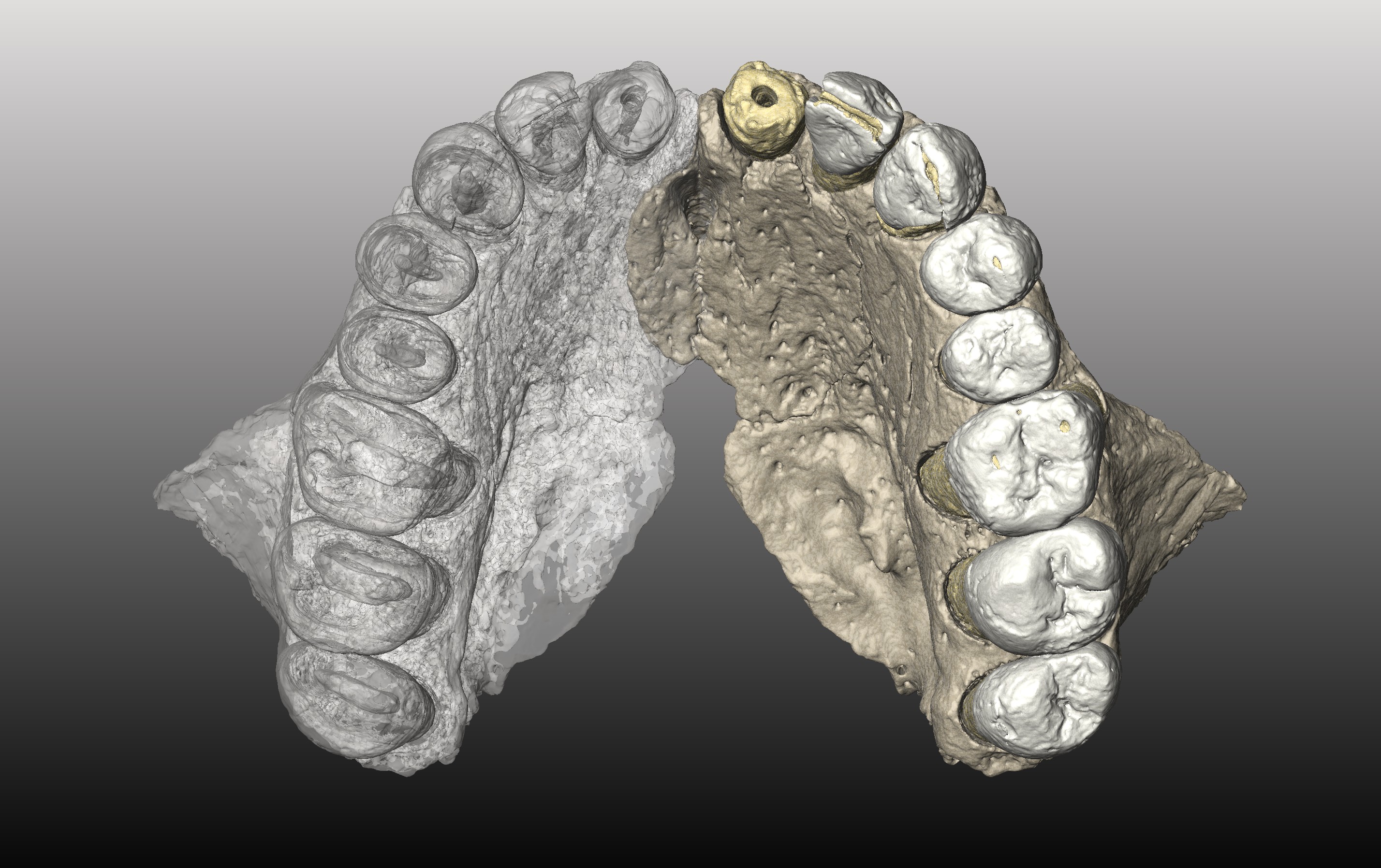 The upper jaw (maxilla) found in Misliya Cave