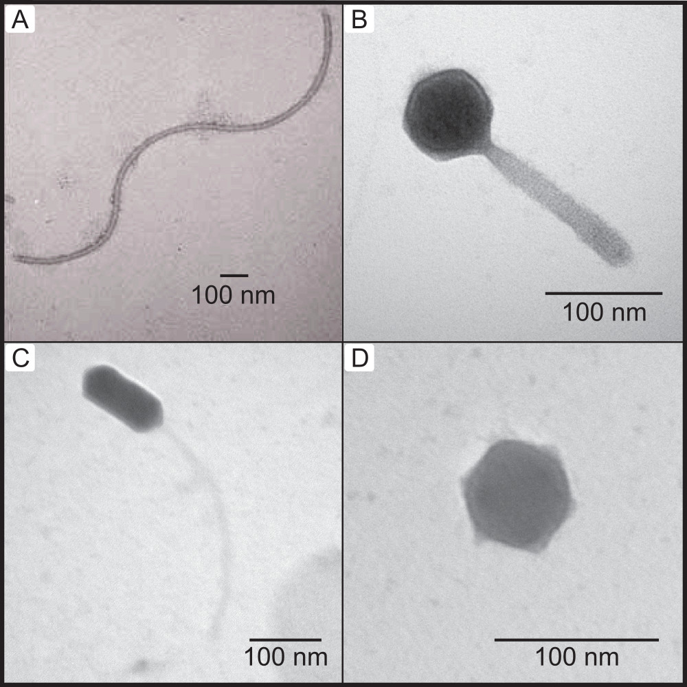 Example of an inovirus viral particle (A) compared with typical dsDNA bacteriophages (B, C, & D) observed with Transmission Electron Microscopy (TEM).