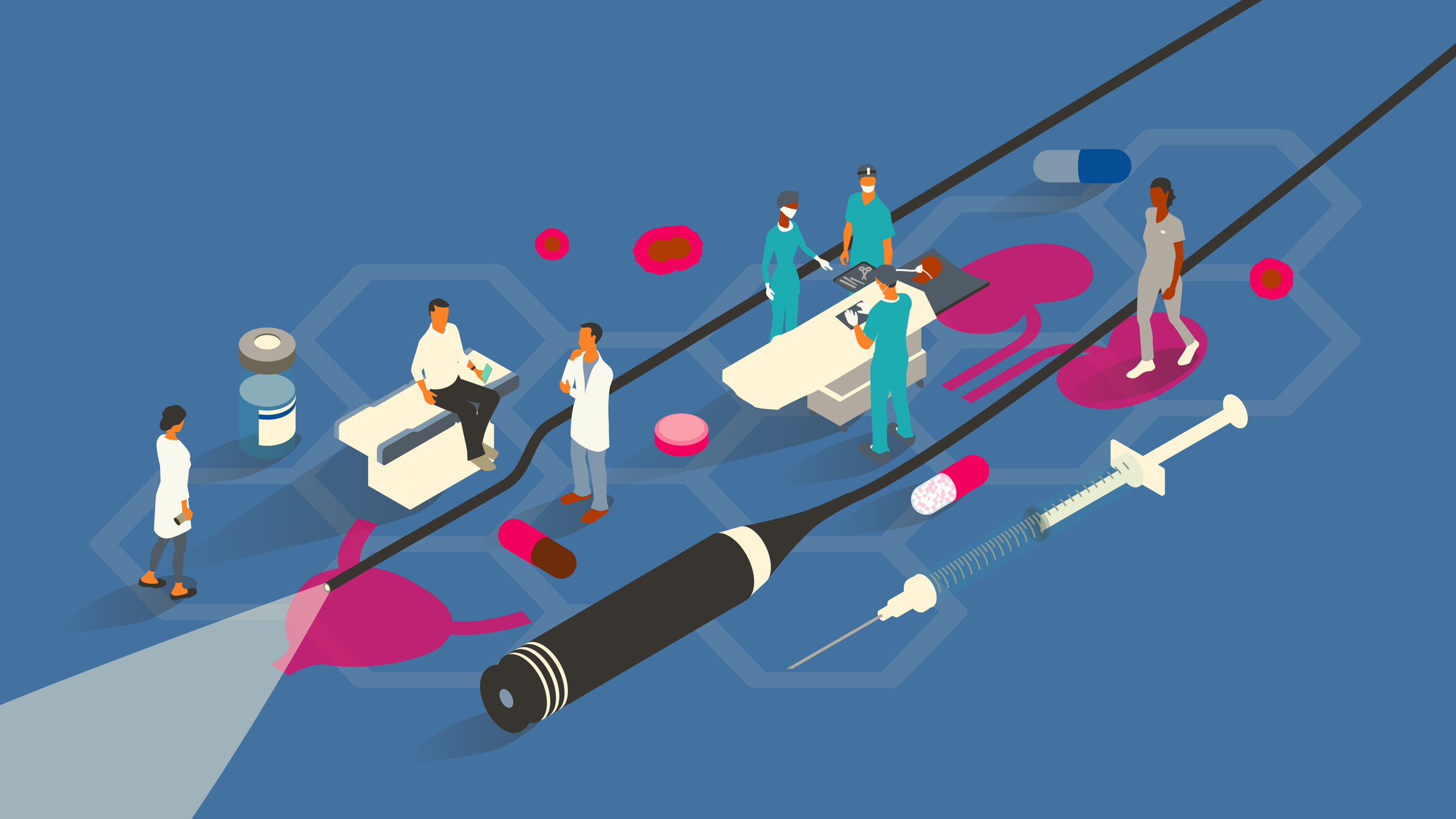 An illustration depicting procedures related to vasectomy