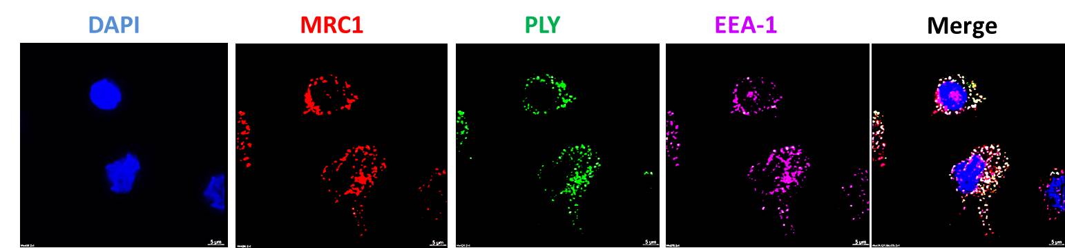 MRC-1 co-localizes with pneumolysin