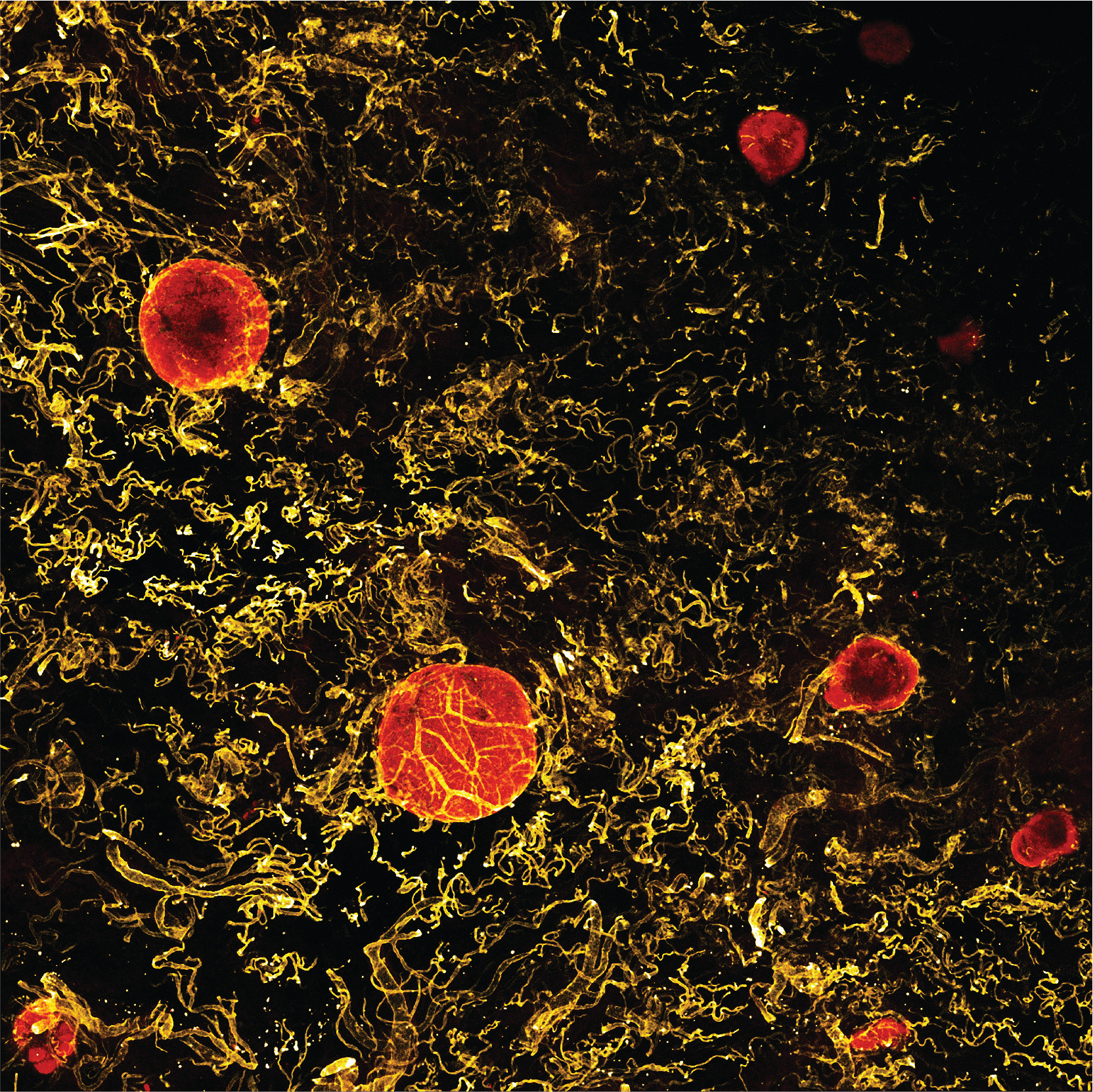 Human colonic Isolated Lymphoid Follicles embedded in submucosal tissue. 