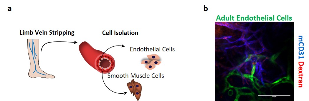Figure 1. Vasculogenic potential of adult limb vein-isolated vascular cells for cell therapy applications. 