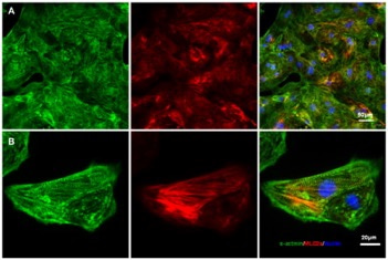 Immunostaining for structural characterization of cardiomyocytes generated from hPSCs