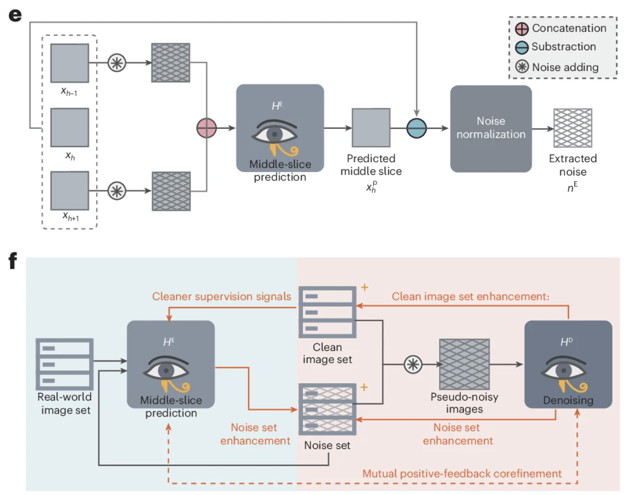 HorusEye development and training strategy