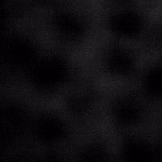 Actin structures visualized via alpha-actinin