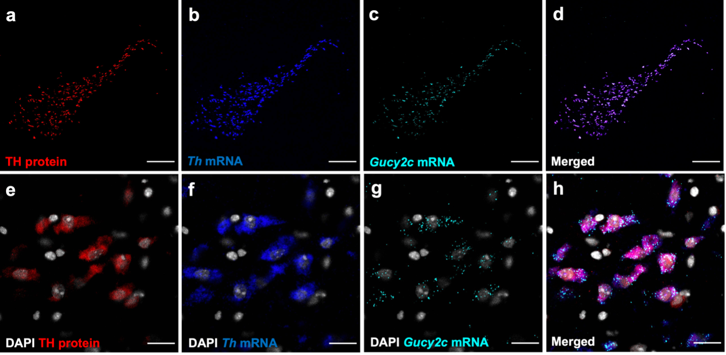 GUCY2C is expressed within dopaminergic neurons of the substantial nigra