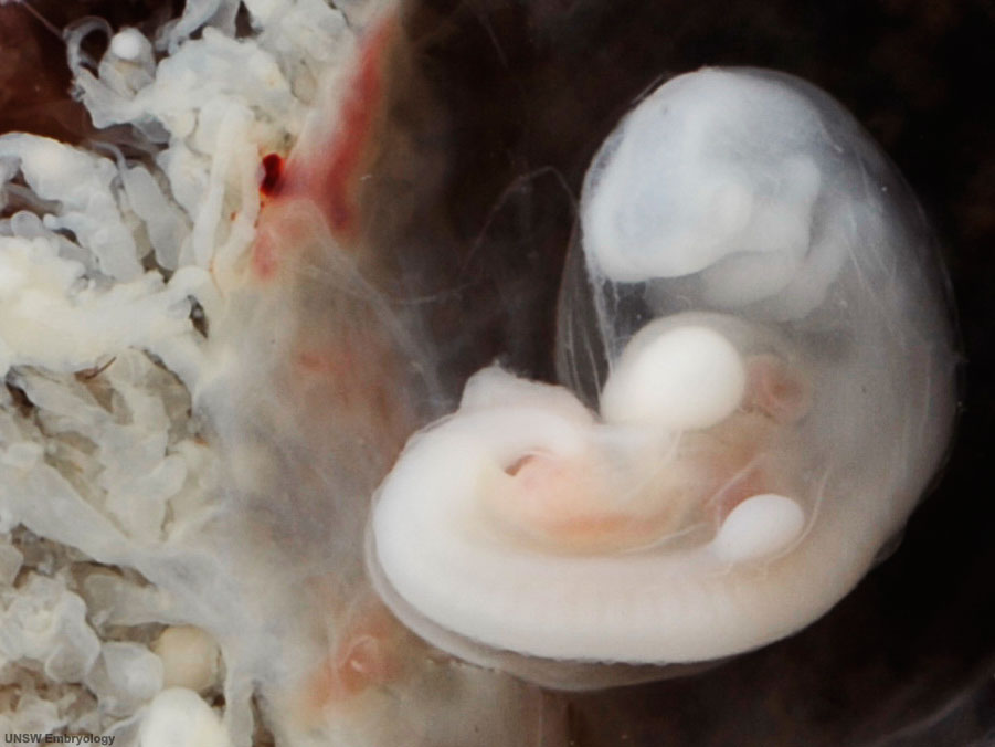 4-week old human embryo
