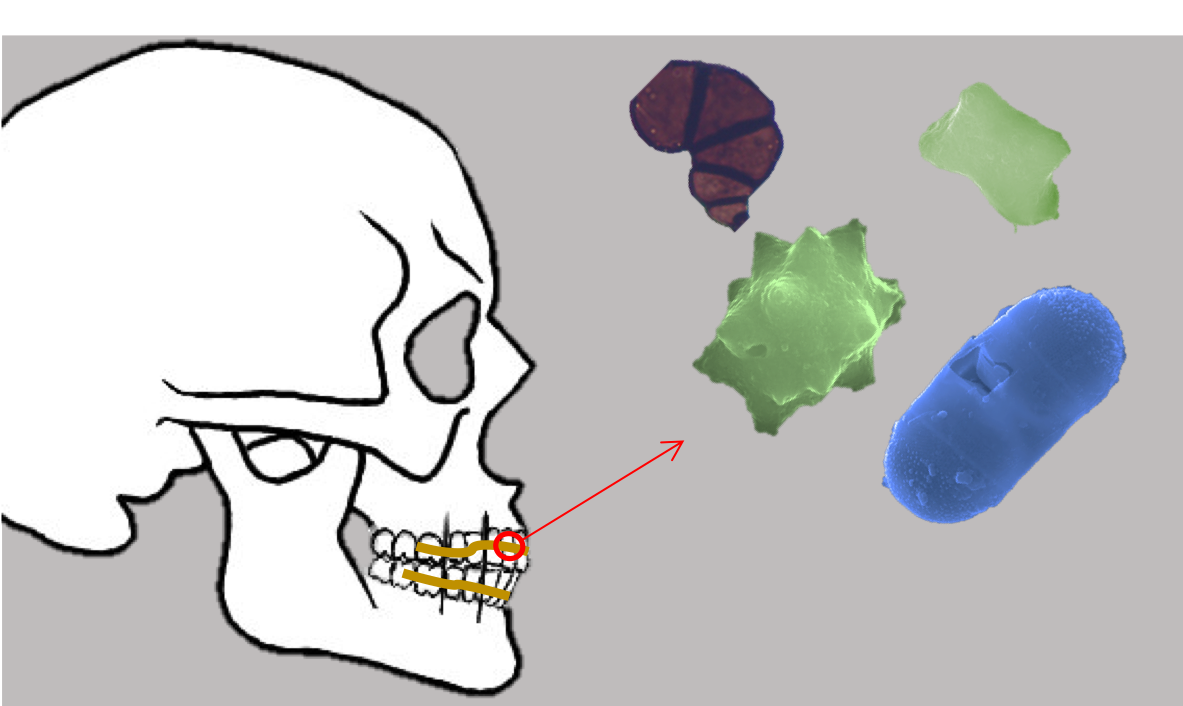 Plant microparticles from dental calculus.