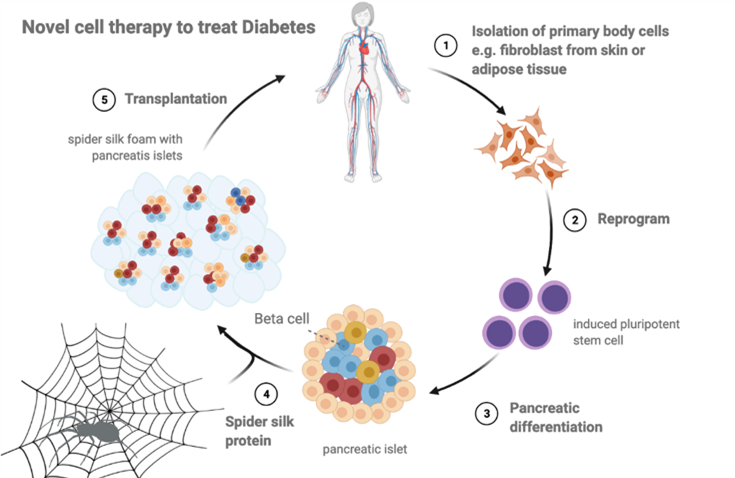 Diagram representing a novel cell therapy to cure diabetes using spider silk