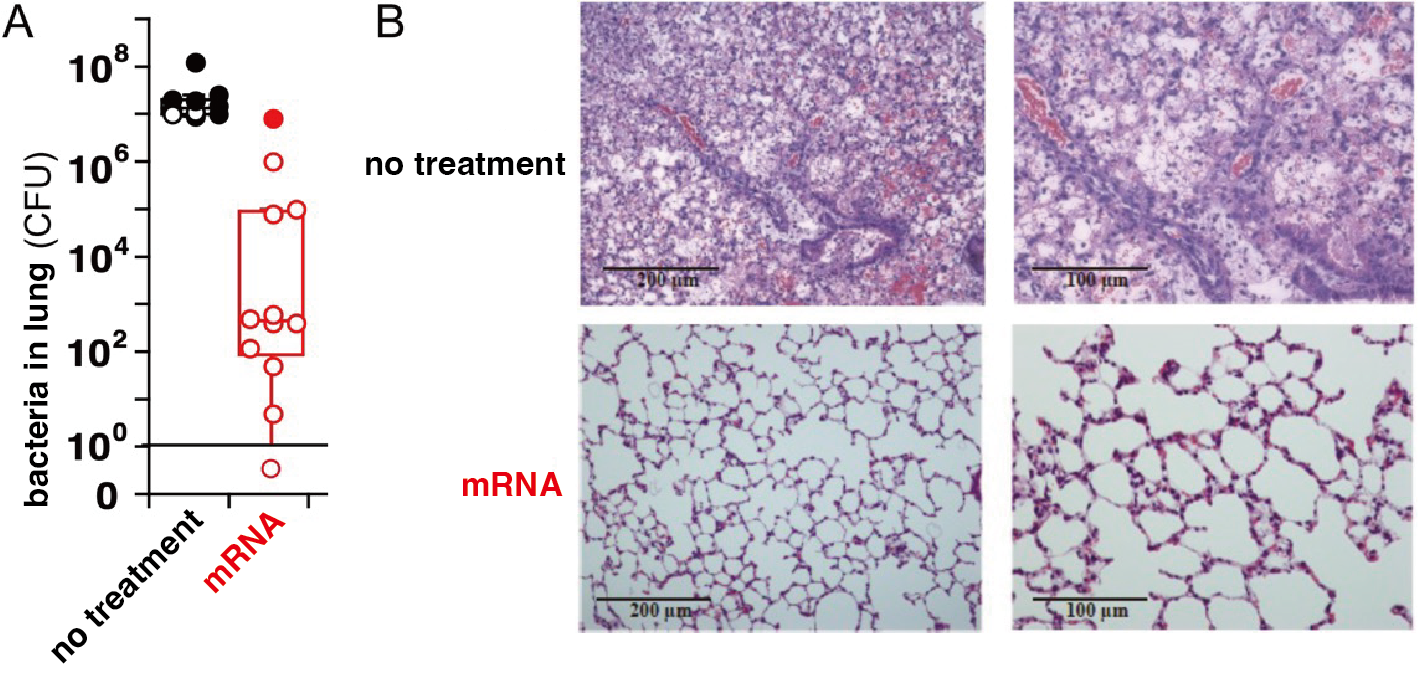 Mechanism of antibody therapy．