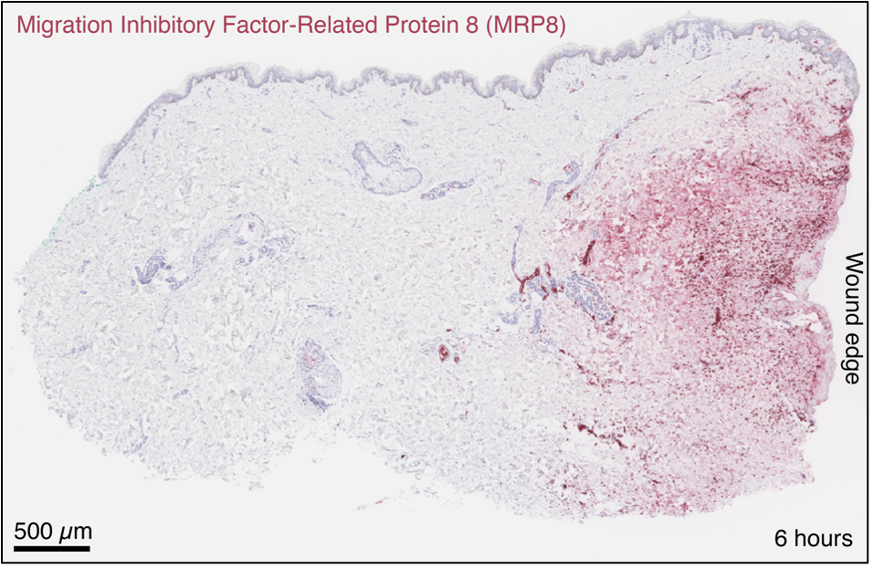 The neutrophil marker MRP8 accumulates at the wound edge.
