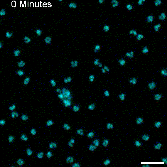Video of neutrophils nucleus swarming around bacterial EVs 