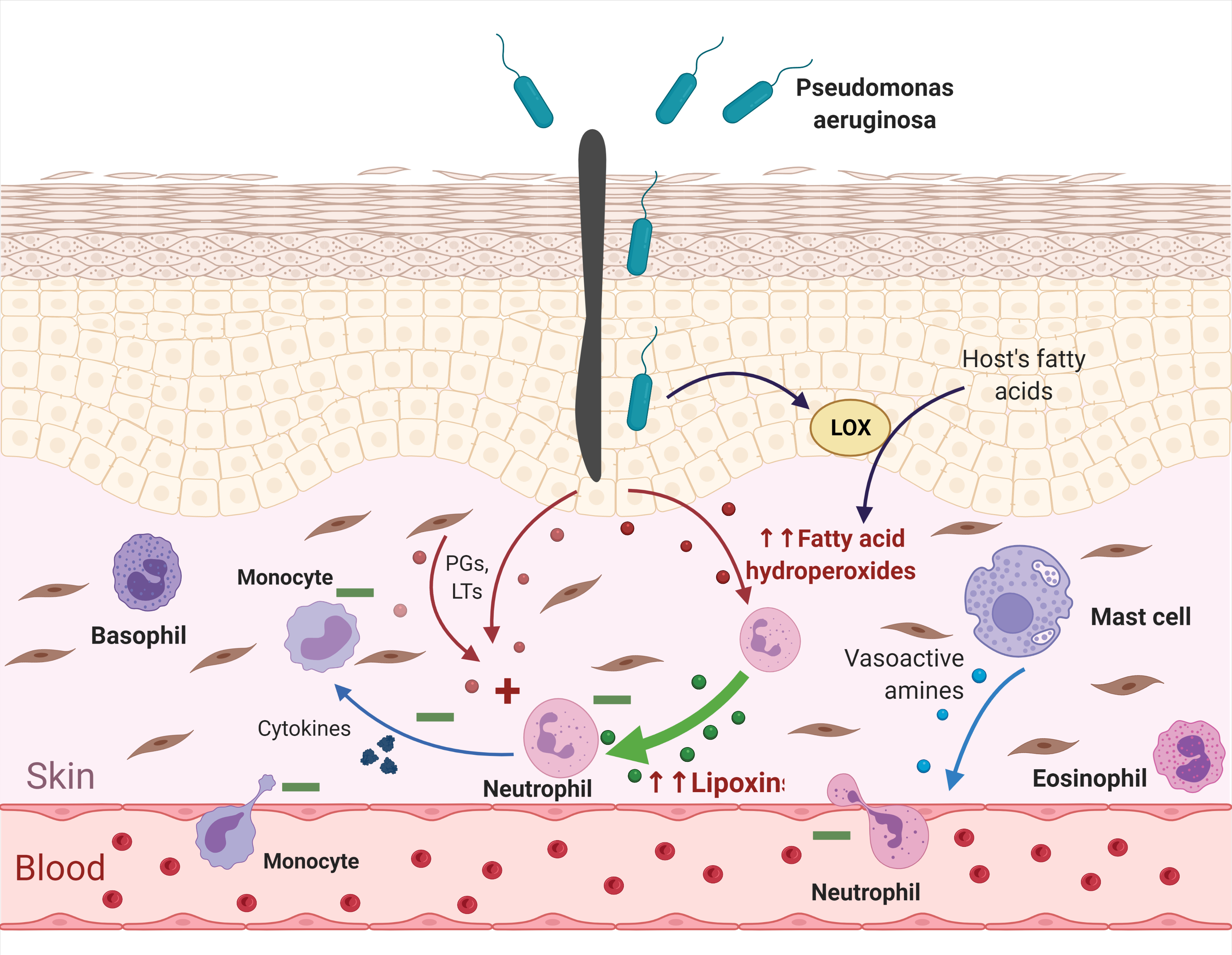 Inflammation pseudomonas