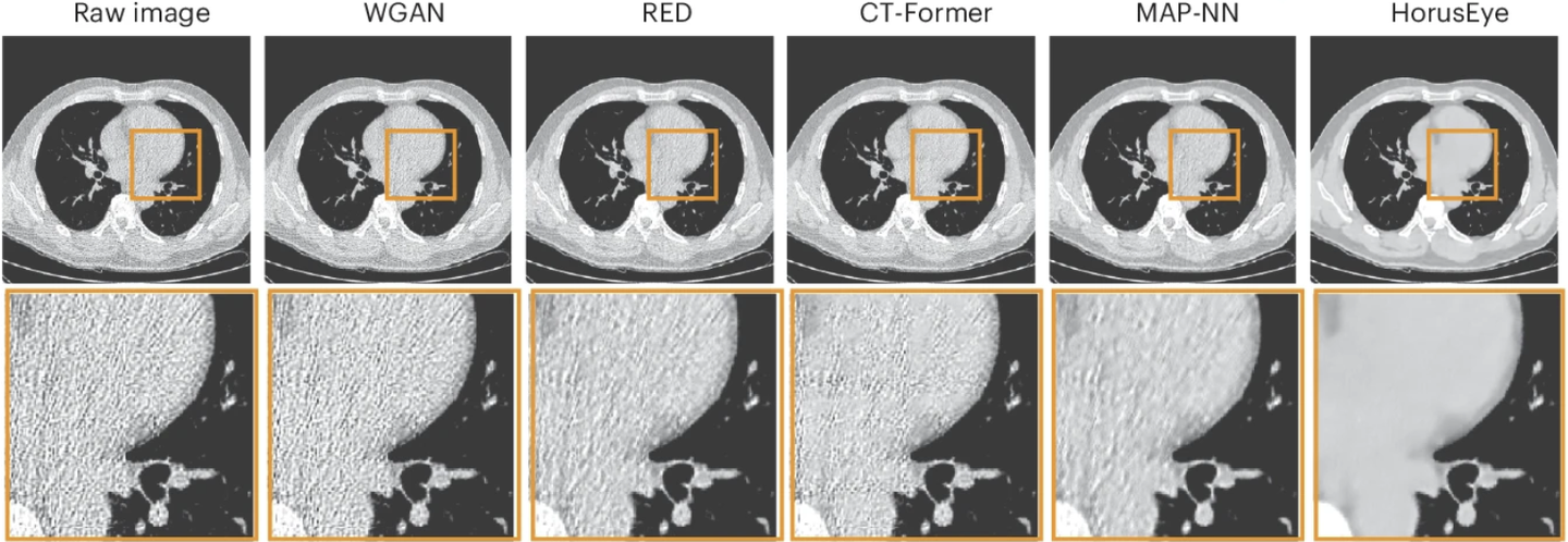 Previous denoising methods largely failed on this dataset