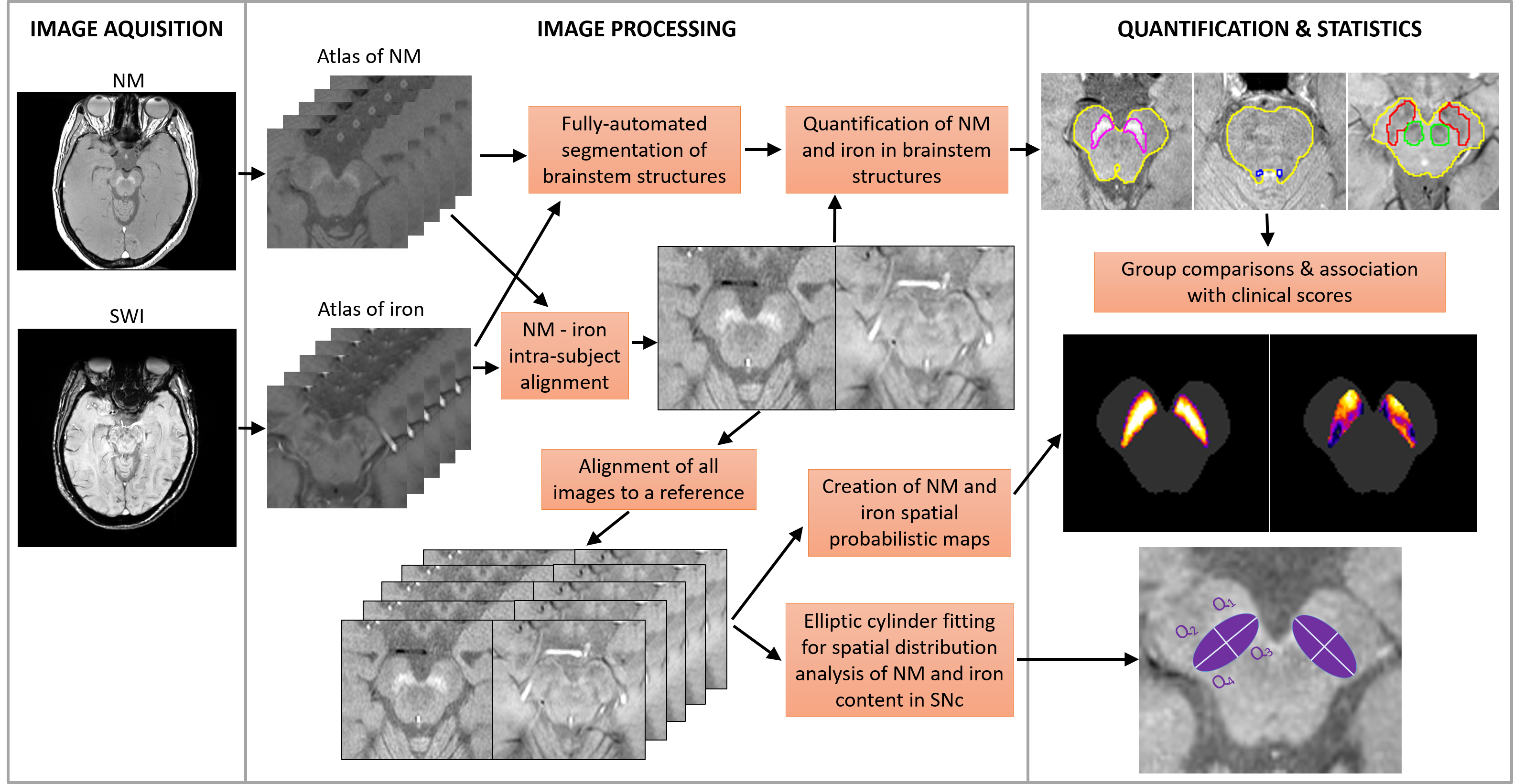 Automated atlas-based segmentation pipeline for NM and iron quantification in the brainstem.
