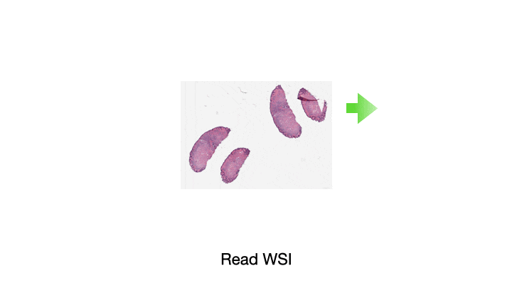An animated illustration of tasks in a CPath pipeline which TIAToolbox can help with.