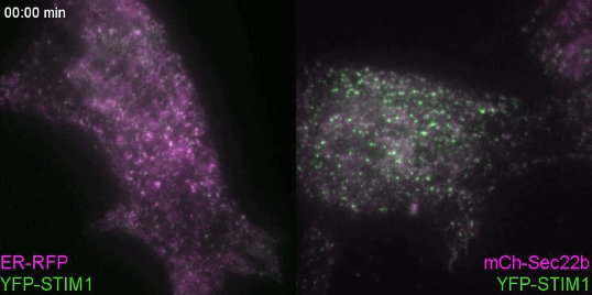 The movie shows data from Figure 3 of the paper where two cells expressing fluorescently-tagged YFP-STIM1 in green and either a control protein called ER-RFP on the left or mCherry-Sec22b on the right in magenta. We add a drug called thapsigargin to activate STIM1 and watch it come to contact sites. In the cells that express STIM1 and Sec22b, the activation of STIM1 is much more vivid.