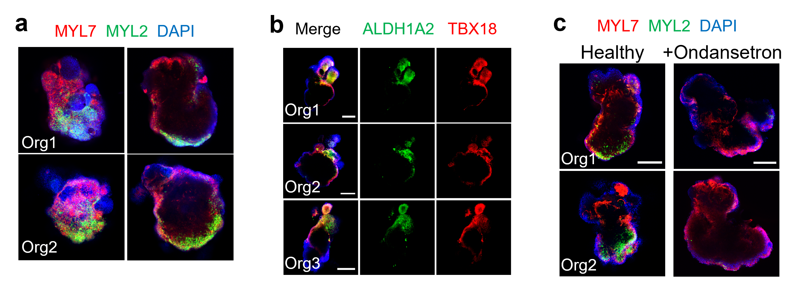 a, Spatial localization of atrial (red, MYL7) and ventricular (green, MYL2) cardiomyocytes.  b, Spatial restriction of the principal retinoic acid synthesis enzyme (green, ALDH1A2) that is colocalized with the epicardium (red, TBX18). c, Organoids cultured without (left) and with (right) ondansetron. Atrial (red, MYL7) and ventricular (green, MYL2) cardiomyocytes are displayed. Blue staining labels all cell nuclei.