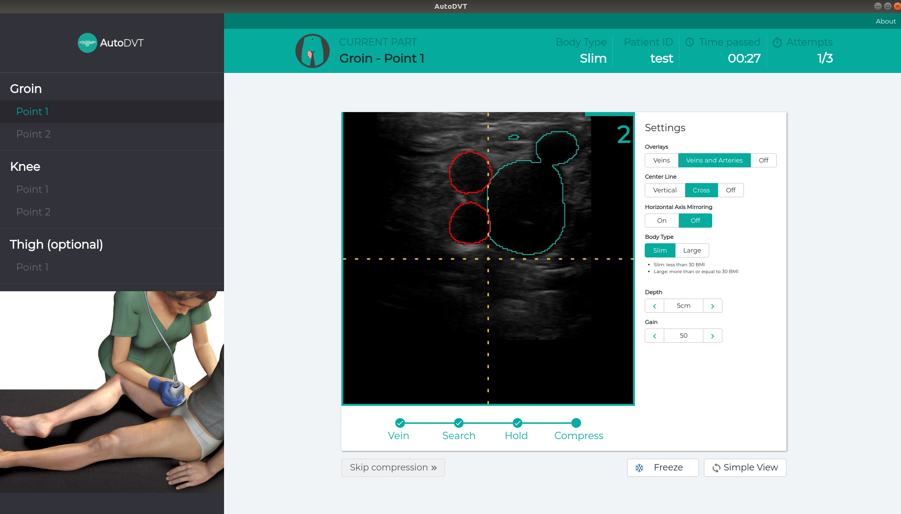 Stage 4 AutoDVT prototype